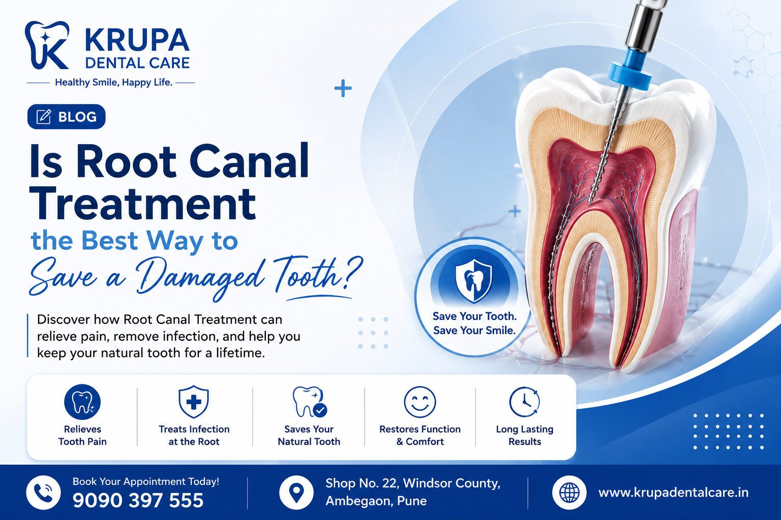 Image Alt Text: Root Canal Treatment at Krupa Dental Care in Ambegaon Pune helping save a damaged or infected natural tooth.